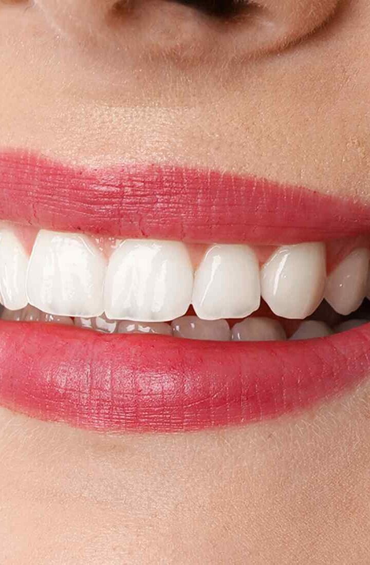 Dental Treatments in Turkey: Affordable, High-Quality Smile Makeovers