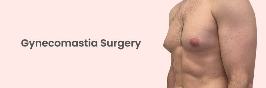 https://anewyoutravel.com/wp-content/uploads/2025/11/Gynecomastia-Surgery-1.jpg