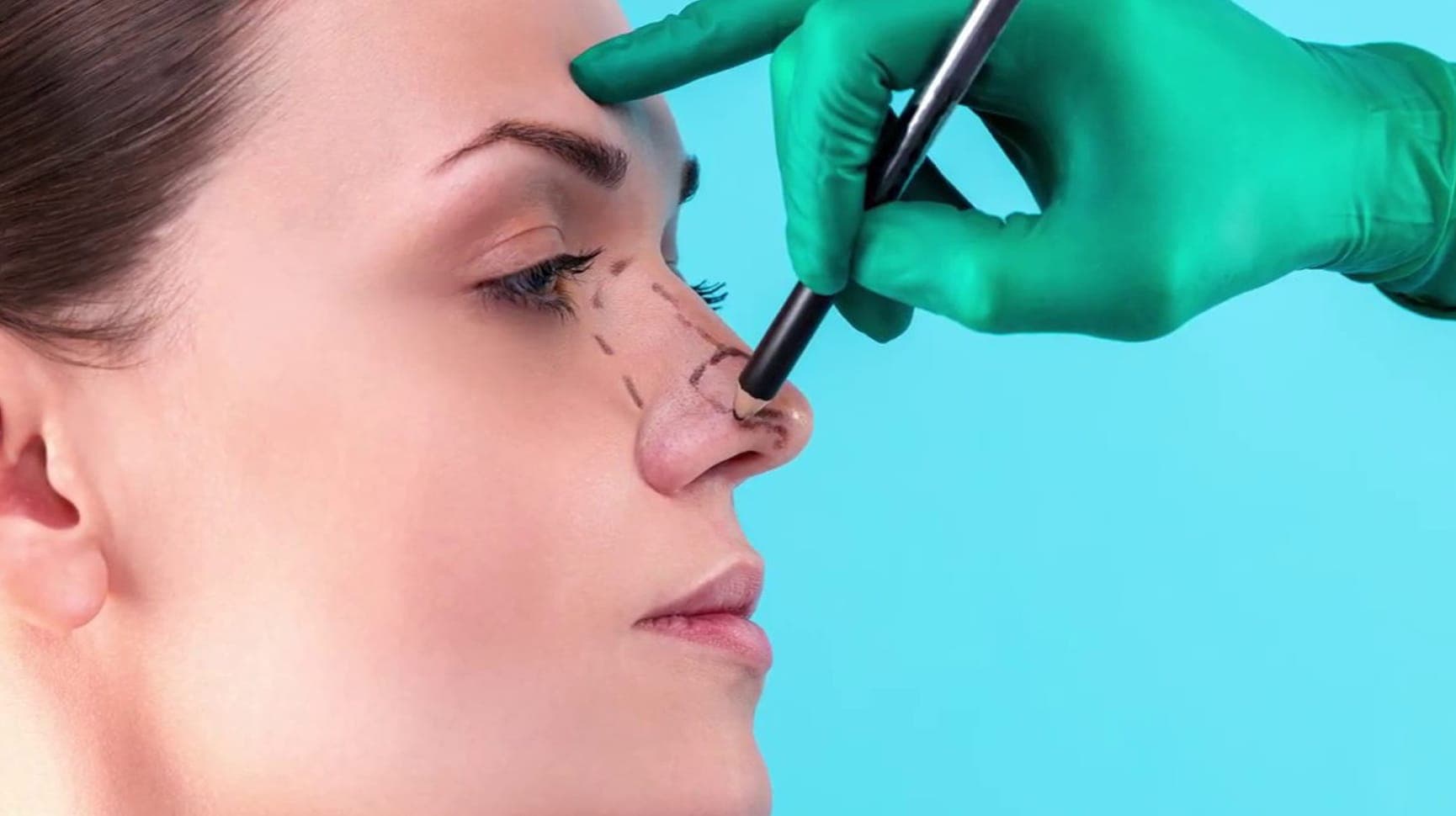 rhinoplasty https://anewyoutravel.com/wp-content/uploads/2025/11/rhinoplasty.jpg
