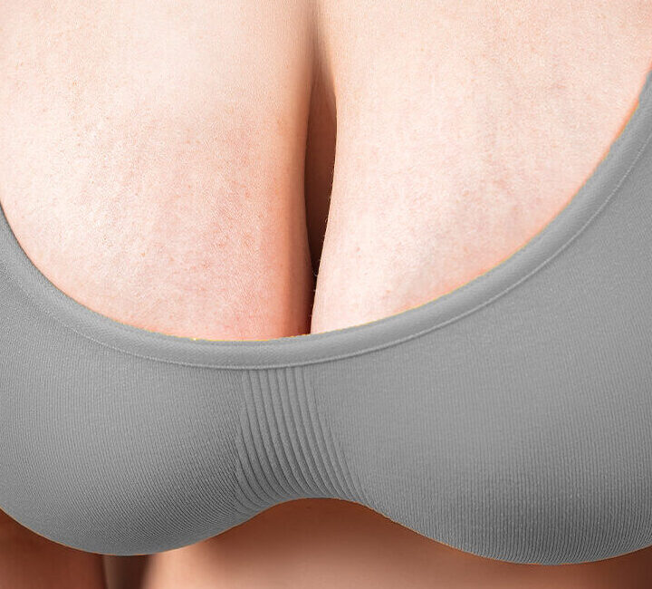 Postpartum Breast Sagging Postpartum Breast Sagging