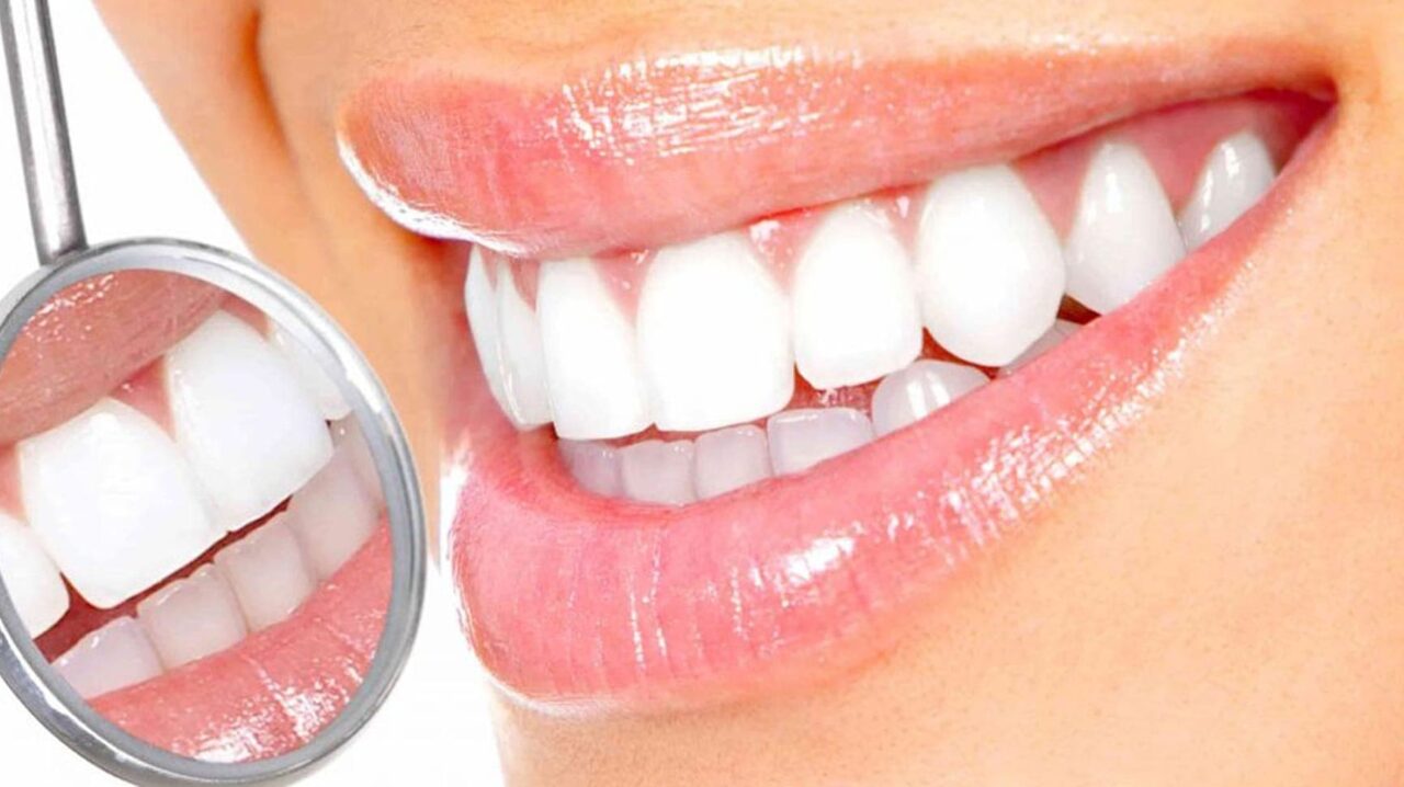 Dental Implants: Are They the Right Choice for You?