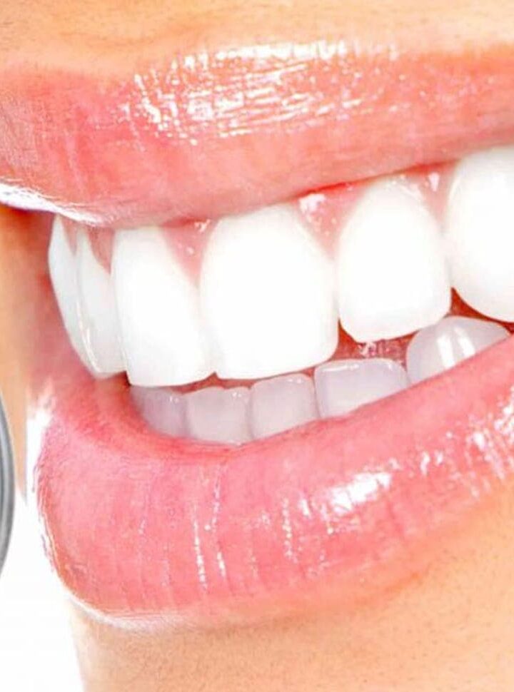 Dental Implants: Are They the Right Choice for You?